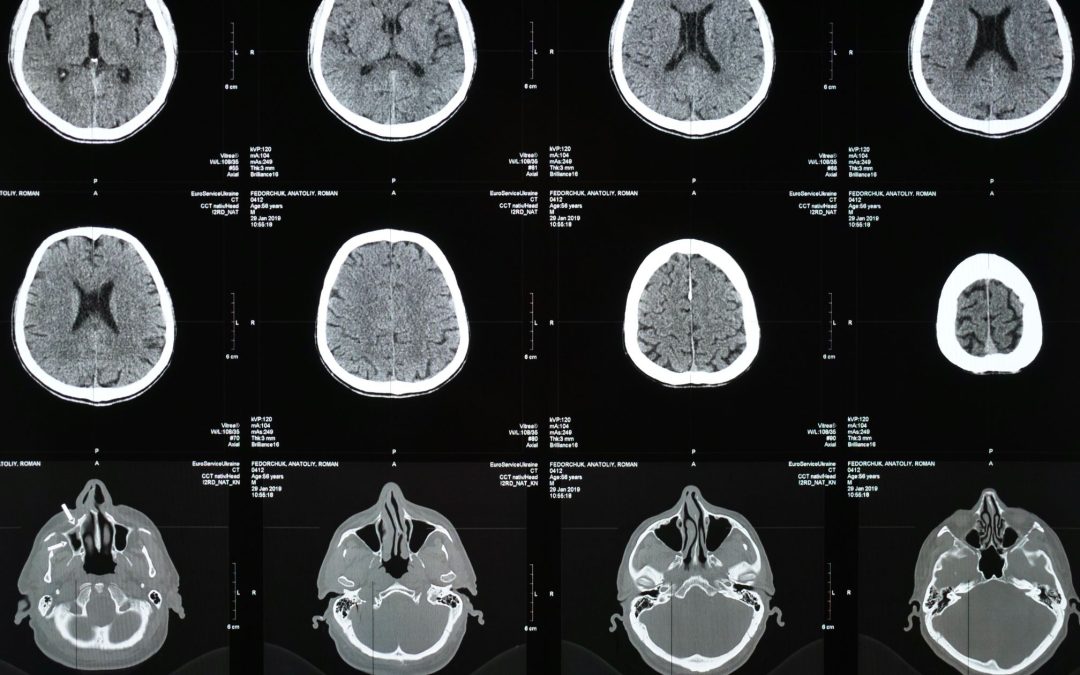 ¿Qué es la radiología intervencionista y cómo puede ayudarte?