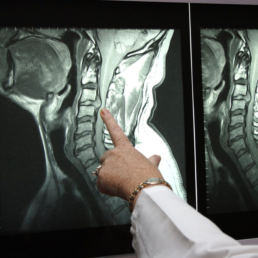 tipos de radiologia rayos
