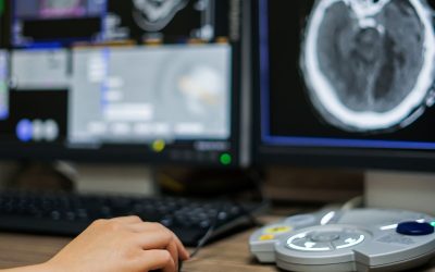 ¿Qué es el radiodiagnóstico? Fundamentos, aplicaciones clínicas y evolución de la especialidad