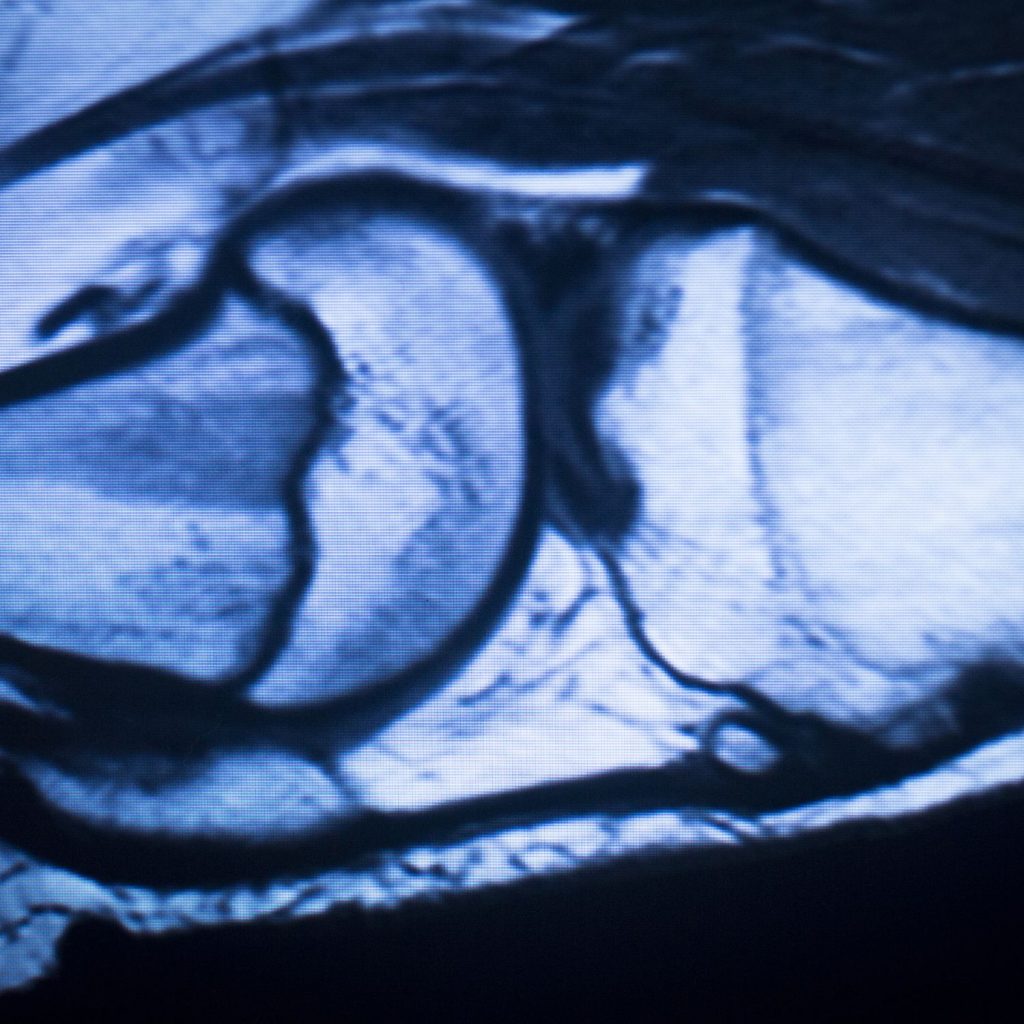 Magnetic Resonance Imaging
